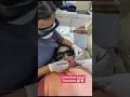 Lagu Laser Root Canal Treatment 😍😍 #dentist #dental #rootcanaltreatment #dentistry #dentalcare