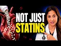 Heart Plaque Statins Aren t Your Only Option Do This First