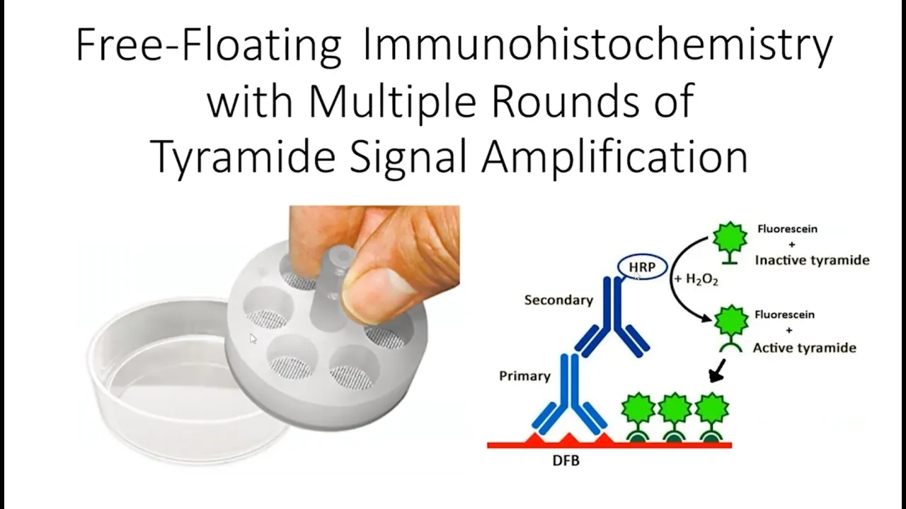 Presentation: Free floating IHC with multiple labeling and tyramide signal amplification
