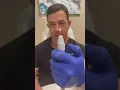 Download Lagu Doctor puts a hole in his own nail! Immediate Relief | 208SkinDoc
