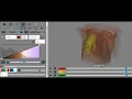 ITKWidgets Chest CT Segmentation Results - Multilabel