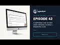 5mins of Postgres E42 A surprising case of very large integers causing a Sequential Scan