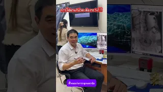 ยาในกลุ่มเอเนะที่ใช้รักษาอาการปวดเนื่องจากไขข้อหรือบาดเจ็บ ควรใช้ติดต่อกันนานเท่าไรจึงจะปลอดภัย