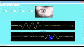 Pupil detection - Python and OpenCV