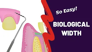 What Is Biological Width And Why Does It Matter
