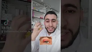 Dr Belaloui Samir Orgelet Ou Chalazion الشعيرة 