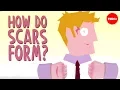 Download Lagu How do scars form? - Sarthak Sinha