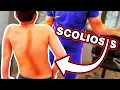 Boy with Spine Issues is HELPED with Chiropractic