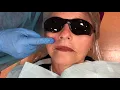 Anterior Superior Alveolar and Infraorbital Nerve Blocks
