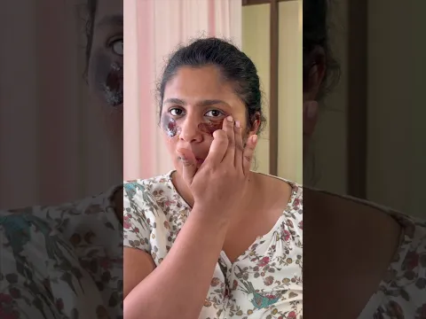 I Tried a DIY to Remove Dark Circles — Here’s What Happened #skincare #darkcircles #diy