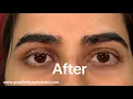 Artificial eye movements