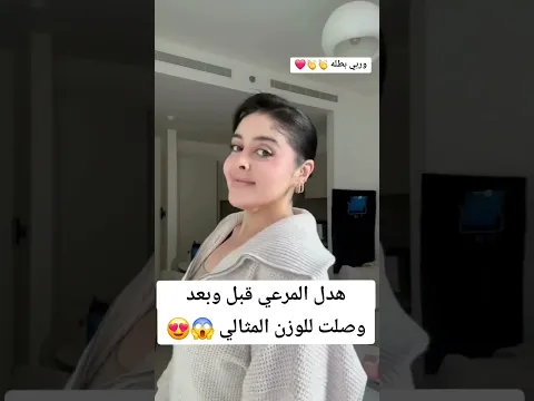 فعلاً السمنة مقبرة الجمال شوفو شلون اتغيرت شكلها