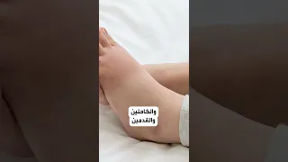 علامات تحذيرية لأمراض القلب والشرايين  علامات تحذيرية لأمراض القلب والشرايين