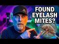 1000x Microscope Exposes the Mites on Your Face Right Now