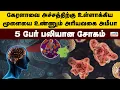 Download Lagu கேரளாவை அச்சத்திற்கு உள்ளாக்கிய மூளையை உண்ணும் அரியவகை அமீபா! - 5 பேர் பலியான சோகம்