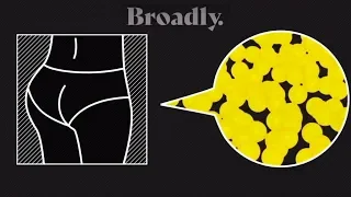 The Instagram Booty Craze BBL with Broadly