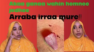 Akaa Ganaa Wahin Himnee Jedhee Arraba Irraa Murre 