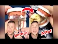 Instant Fake Teeth In SECONDS Orthodontist Reacts