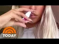 Doctors Warn Against Viral Nasal Spray Tanning Trend