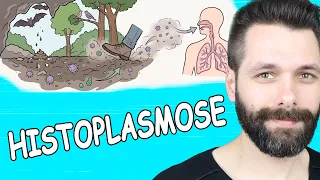 HISTOPLASMOSE - Doenças Causadas por Fungos - Microbiologia | Biologia com Samuel Cunha
