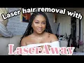 LASER HAIR REMOVAL ON BLACK SKIN LaserAway EXPERIENCE Andrea Scarlett