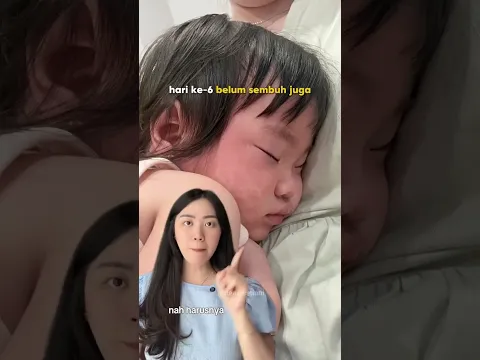 Demam Berhari-Hari, Terus Muncul Ruam?😳