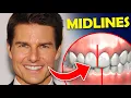 Why Tom Cruise s teeth look off - how to fix a midline