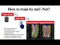 nnU-Net How to Train Ep