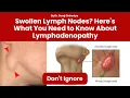 Swollen Lymph Nodes Here s What You Need to Know About Lymphadenopathy