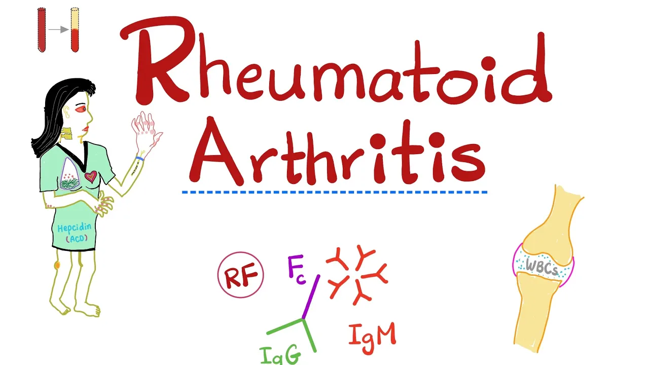 Rheumatoid arthritis (RA)- Signs and Symptoms - Extra-articular manifestations - Part 6