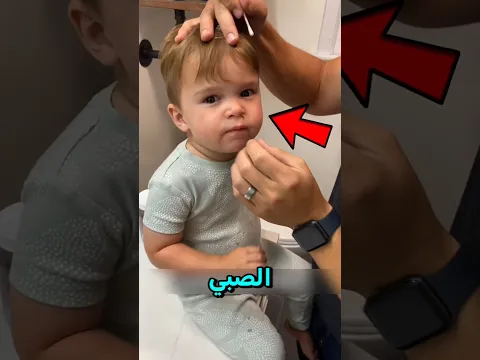 شيء ما كان عالقًا داخل أنف هذا الصبي 😱! #shortvideo #اكسبلور #song #معلومات #قصص #shorts