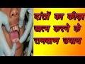 Finish the tooth worm within few days,danto ka kida kaise khatm kare, healthtipshindigyan