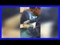 Download Lagu Plastische borstchirurgie in Turkije