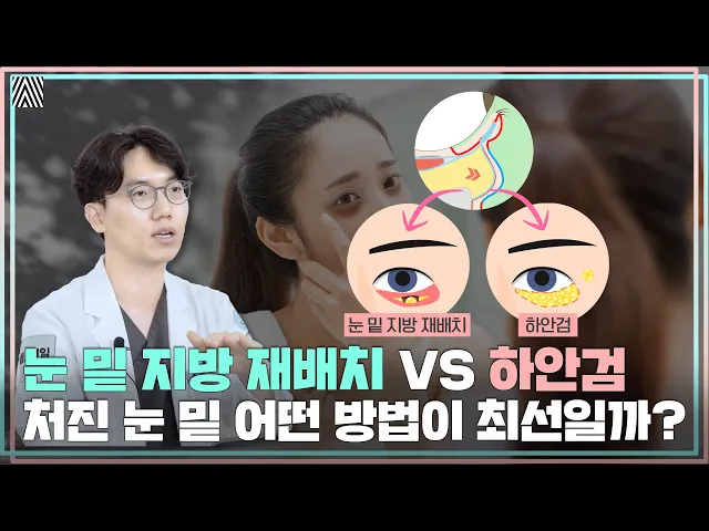 병원마다 다르게 권유하던데... 눈 밑 지방 재배치vs하안검 최종 선택은?_[4월31일 성형외과]