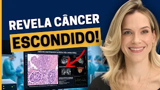 HOLEP: A CIRURGIA A LASER QUE PODE REVELAR UM CÂNCER ESCONDIDO
