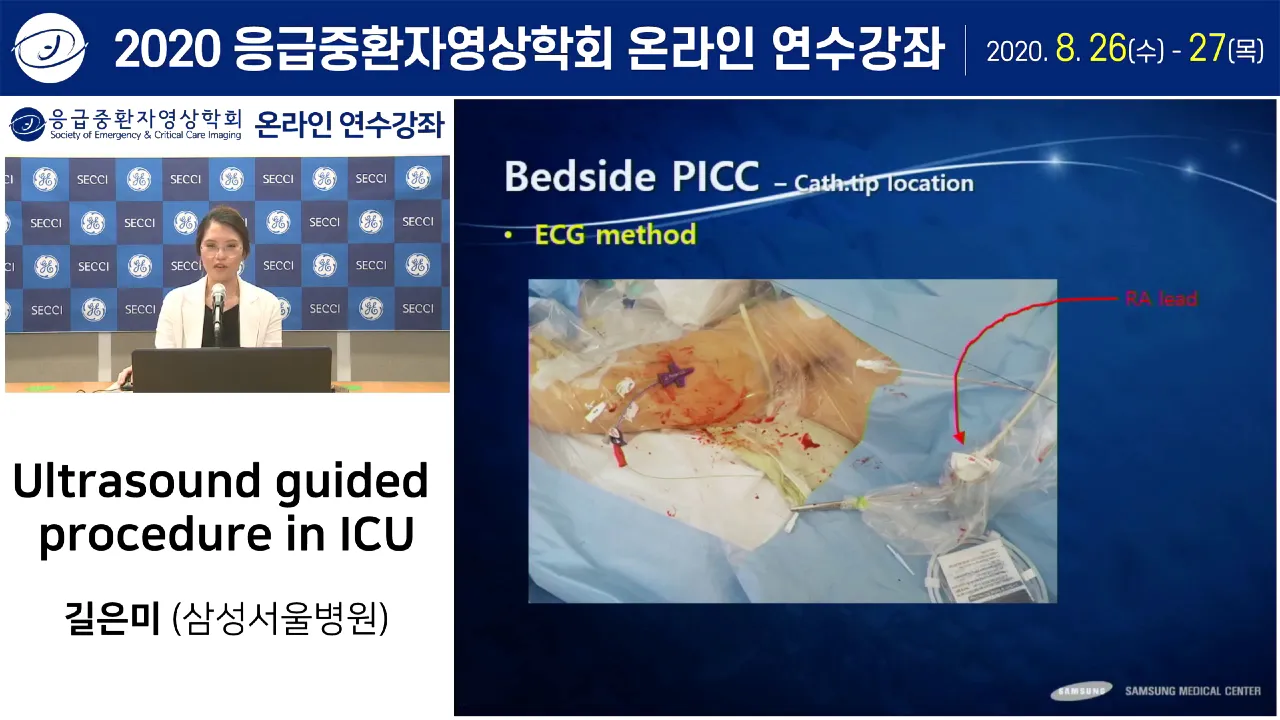 ★★초음파 유도하 정맥관 삽입술 Axillary v, femoral v, PICC/ MC 길은미 [2020 SECCI 온라인연수강좌]