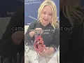 Impella Device How Impella works for heart failure Impella demo