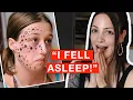 Teen Accidentally Gets Face Tattooed