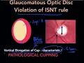 High Yield Topic Optic Disc Changes in Glaucoma - The Complete Course