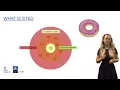 Mastering Imaging Challenges Overcoming High Background Fluorescence and Low Target Expression
