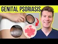 Doctor explains GENITAL PSORIASIS Causes symptoms and TREATMENT