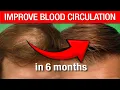 Download Lagu Microneedling for Hair Loss? Why I Stopped (and What Works Better)