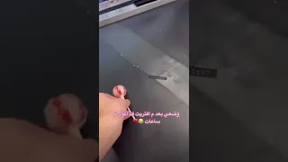 وضعي بعد م افتريت في المول   ساعات دندنها