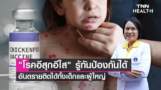 อิสุอิสัยเกิดจากเชื้ออะไร และติดต่อทางใดบ้าง