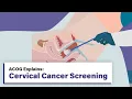 ACOG Explains Cervical Cancer Screening