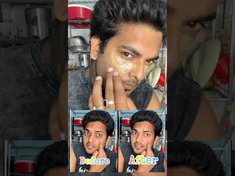 #ytshorts