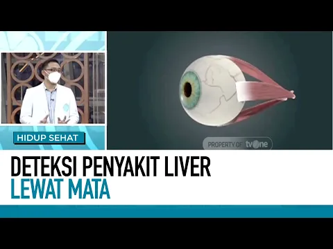 Begini Cirinya Jika Kamu Mengalami Penyakit Liver | Deteksi Penyakit