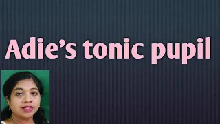 Download Adie's tonic pupil || Holmes adie's pupil || Diluted pilocarpine test || Mnemonic for Adie's pupil MP3