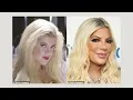 R.I.P. to these Anti-Aging Procedures - AVOID Over 50!!