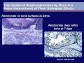 Download Lagu Zoledronic Acid Once Yearly Infusion: A Step Forward in Fracture Prevention